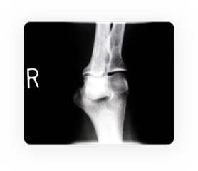 ubezpieczenie z badaniami radiologicznymi i endoskopowymi